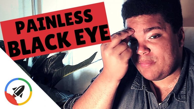 How to Give Yourself a Black Eye